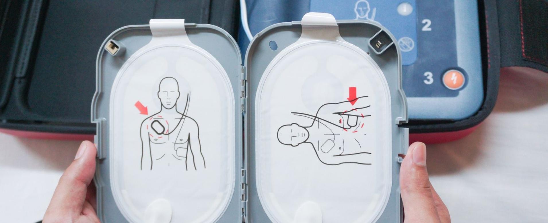 Defibrillator Geöffneter Defibrillator mit Anzeigen auf dem Display.